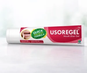 Topical USOREGEL mouth ulcer gel for relief from oral pain and burning sensation.