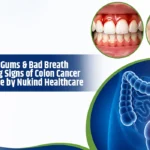 Bleeding Gums & Bad Breath: Early Warning Signs of Colon Cancer | A Health Guide by Nukind Healthcare