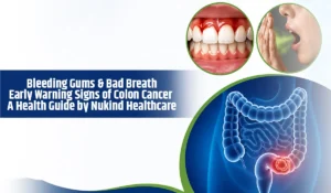Bleeding Gums & Bad Breath: Early Warning Signs of Colon Cancer | A Health Guide by Nukind Healthcare