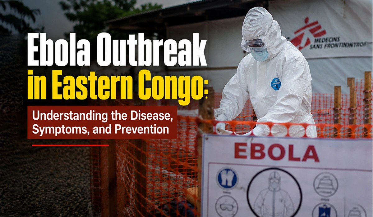 Learn about the Ebola outbreak in Eastern Congo, including symptoms, transmission, prevention, treatment options, and how global health agencies are responding. A comprehensive, evidence-based guide.
