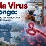 Ebola Virus in Congo: Understanding the Health Crisis and How Ebola Spreads